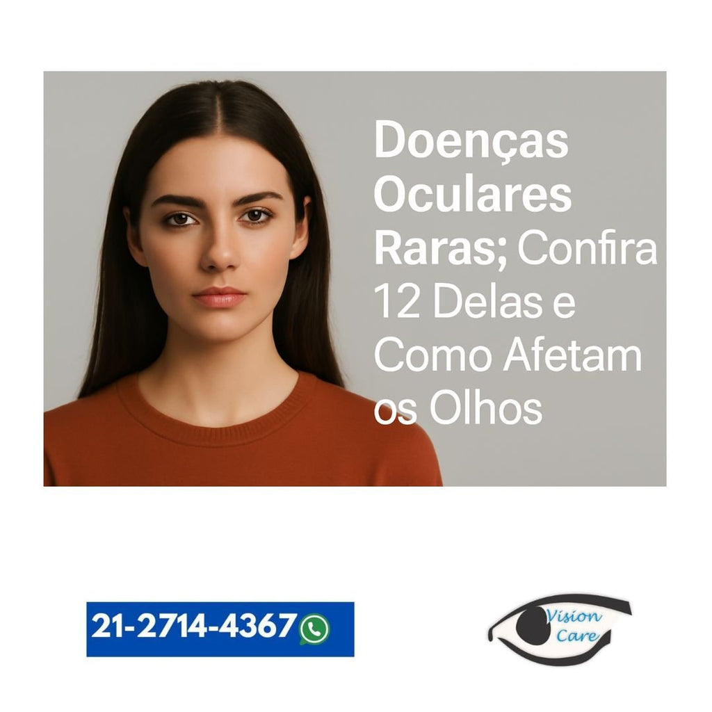 Doenças Oculares Raras: Confira 12 Delas e Como Afetam os Olhos