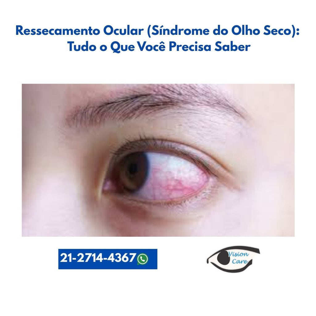Ressecamento Ocular (Síndrome do Olho Seco): Tudo o Que Você Precisa Saber